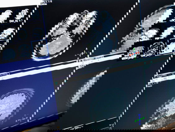 Hoe kun je je geheugen versterken?