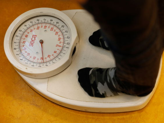 Zelfbeschikking maakt rechtszaken over anorexia moeiijk, gesteggel om nieuwe behandelmethode