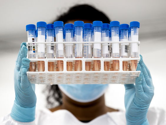 Ben je altijd besmettelijk als je het coronavirus draagt?