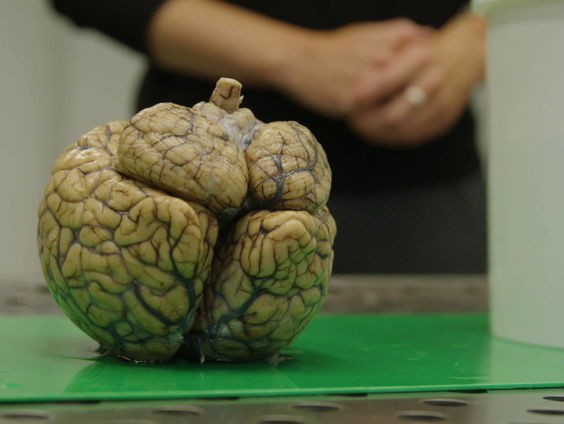 Waarom ons brein de dingen groter maakt dan ze zijn