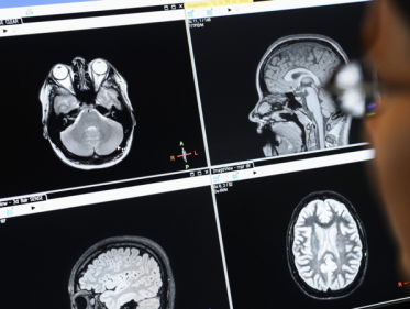 Onderzoek van Pieter Roelfsema: een bril met een camera erin wordt gekoppeld aan de hersenen van de visue ...