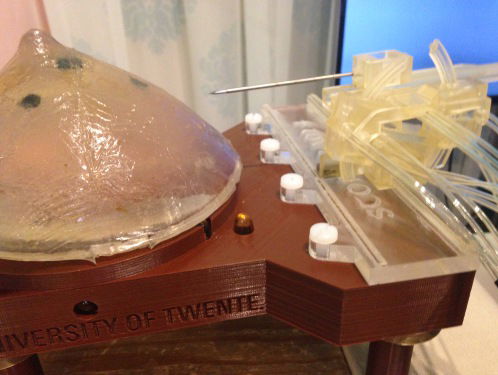 U wordt geopereerd door... een robot