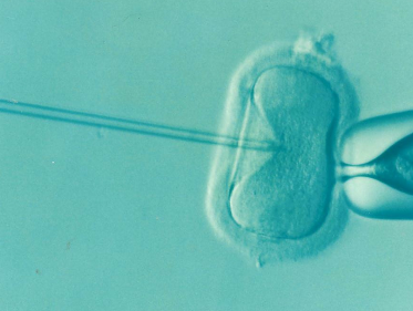Homostel wint en verliest rechtszaak over IVF vergoeding