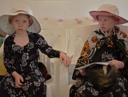 Internationale Dag van het Albinisme