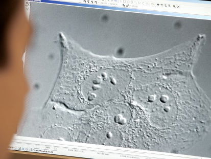 Een op de drie kankerpatiënten ondervindt gevolgen coronacrisis