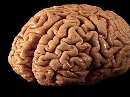 Het plastische brein