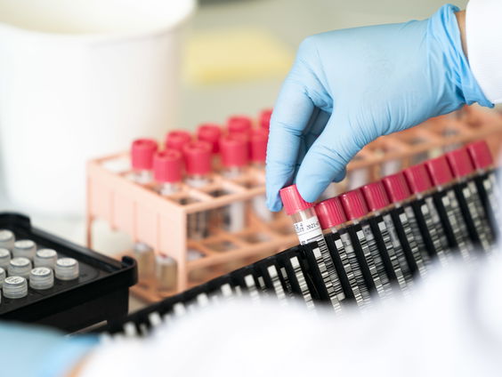 GGD: vanaf vandaag kan iedereen een coronatest laten doen