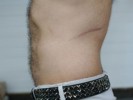 Waardevol onderzoek naar illegale orgaanhandel