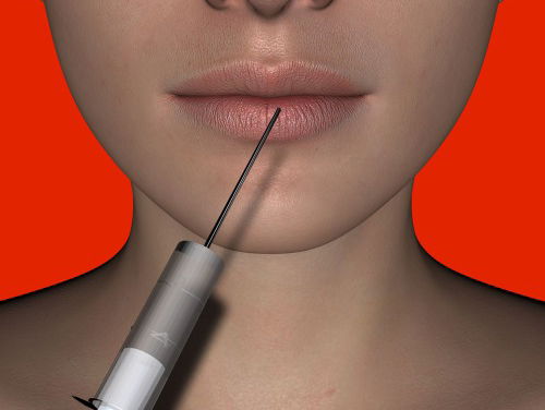 Plastische chirurgie steeds normaler