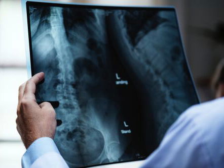 Jonge doctor: meer postmortaal onderzoek