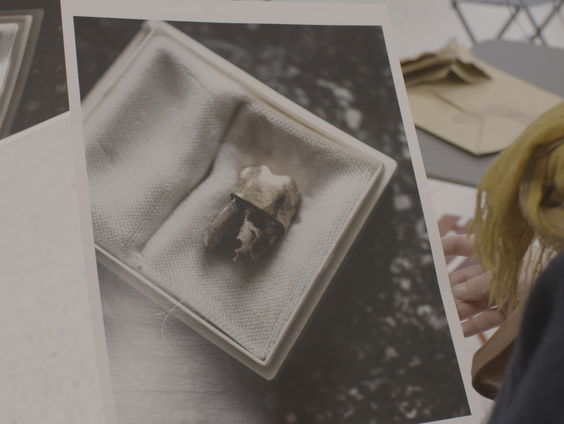 Aan het Belgisch geweten knaagt een tand