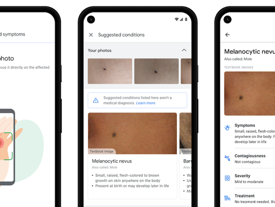 Google komt met huidscan-app