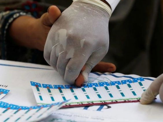 Vooruitgang in aidsbestrijding afgeremd door coronacrisis