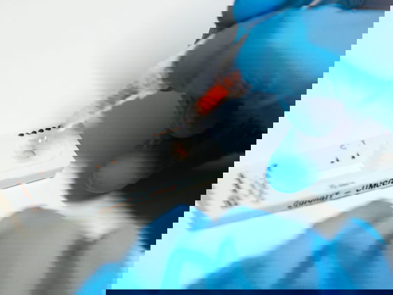 Ministerie: bij milde klachten mag zelftest ook, GGD niet noodzakelijk