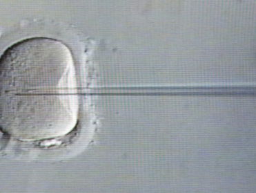 Hooggerechtshof Alabama beschouwt ingevroren embryo's als kind: wat zijn de politieke gevolgen?
