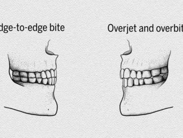 Oermensen spraken de 'F' en de 'V' amper uit