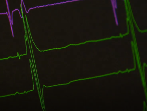 Hartpatiënten in de knel door corona
