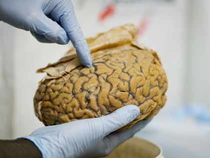 Opnieuw discussies over het op wetenschappelijke manier herkennen van homoseksualiteit