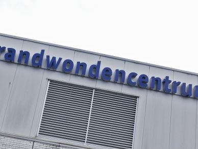 Littekens brandwondpatiënten beter genezen dankzij nieuwe beoordelingsmethode