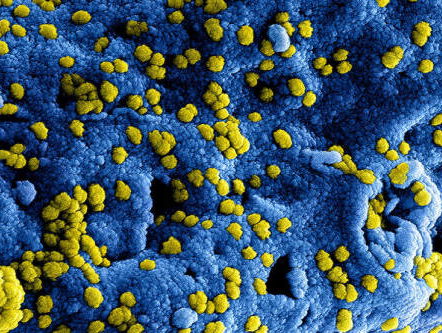 Hoeveel mensen hebben al weerstand opgebouwd tegen het coronavirus?