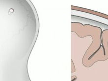 Elon Musk wil je hersenen aan een computer koppelen