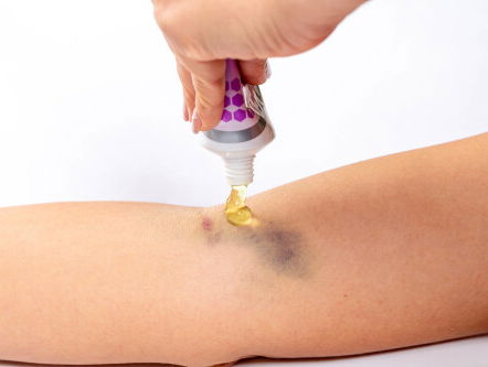 Als ik een zalfje met pijnstiller na 10 minuten nog een keer smeer, heb ik dan een dubbele dosis pijnstiller te pakken?