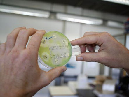 Moeten we ons zorgen maken over de superbacterie?