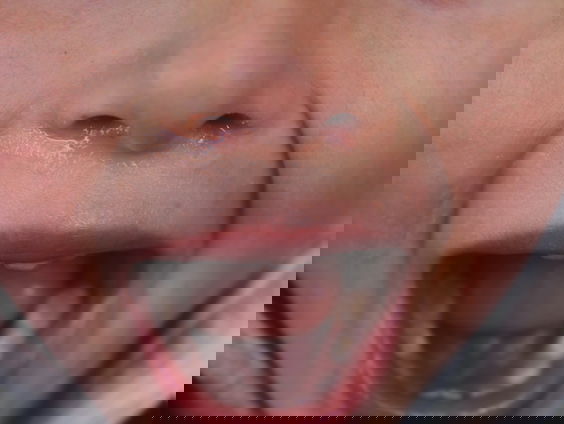 SOA: Hoe ga je om met mensen die uit hun mond ruiken?