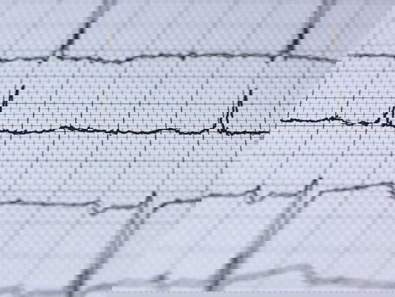 Een heftig reanimatieverhaal...