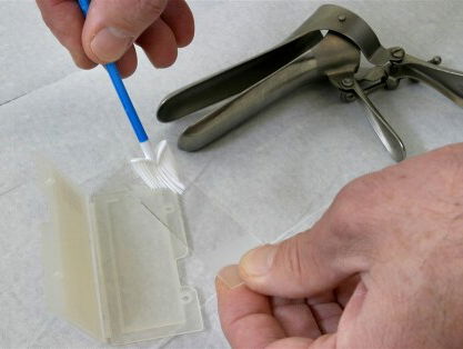 Een uitstrijkje maken kan voortaan thuis. Dr. Felicia legt uit