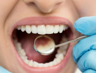 Heb jij ook een buitenlandse tandarts?