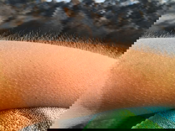 HZD: Waarom krijgen we kippenvel?