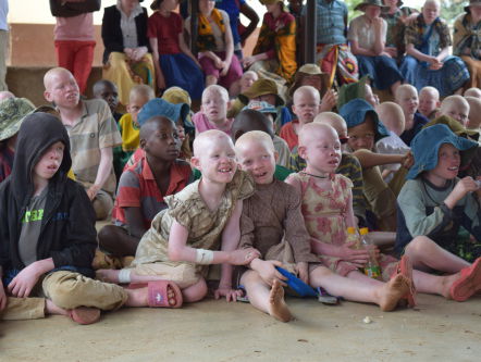 Albino's in Afrika sterven niet, ze verdwijnen