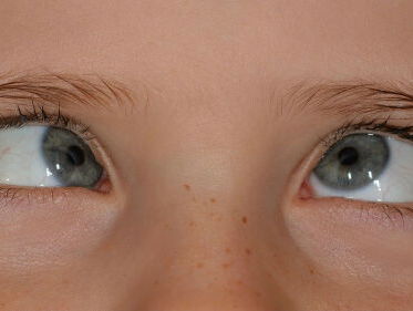 Secondelijm ipv oogdruppels