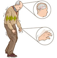 Een doorbraak in onderzoek naar Parkinson?