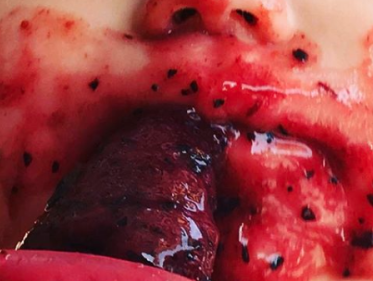 De Koelkastcoach - Wat eet je met dit warme weer?