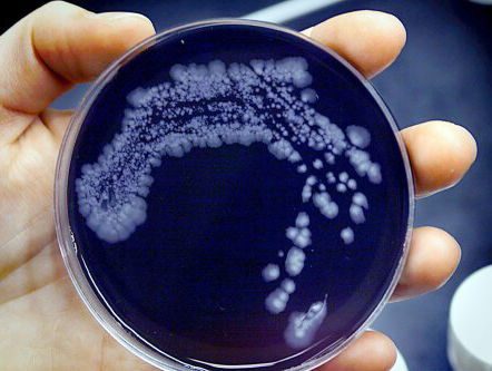 Stijging in het aantal legionella besmettingen