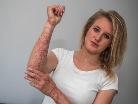 OMG. Tessa werd aangevallen door een kwal van 15 meter!!