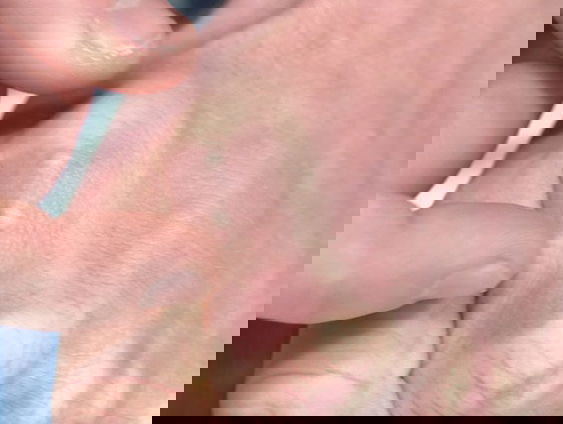 Geen gat maar een chip in je hand, dat heeft IJsbrand