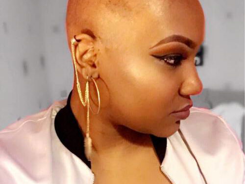 Milendi vertelt hoe het is om Alopecia te hebben! 2/2