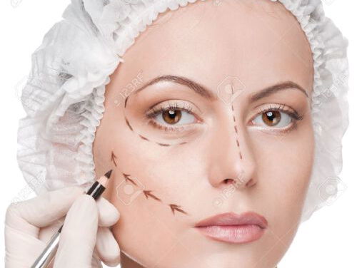 Moet de leeftijdsgrens voor botox en fillers omhoog?