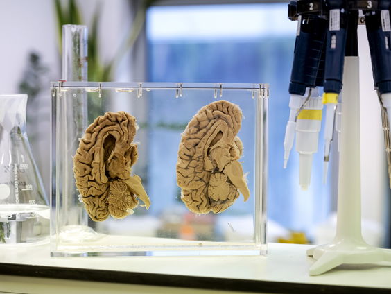 Promovenda Soha Farboud onderzoekt hoe je het brein kunt boosten