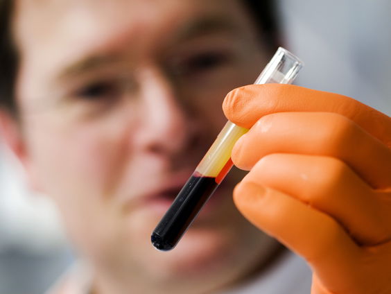 Ook jij hebt te veel PFAS in je bloed: tijd om het te verbieden?