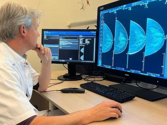 Onderzoek toont aan: A.I. is een goede collega voor de radioloog