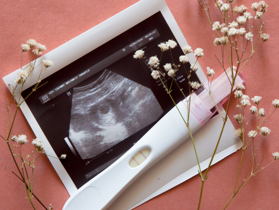 Onderzoek om herhaaldelijke miskramen te voorkomen