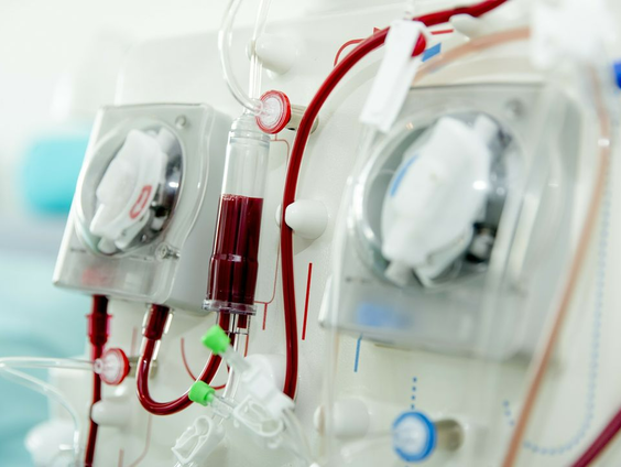 Nierstichting test draagbare kunstnier