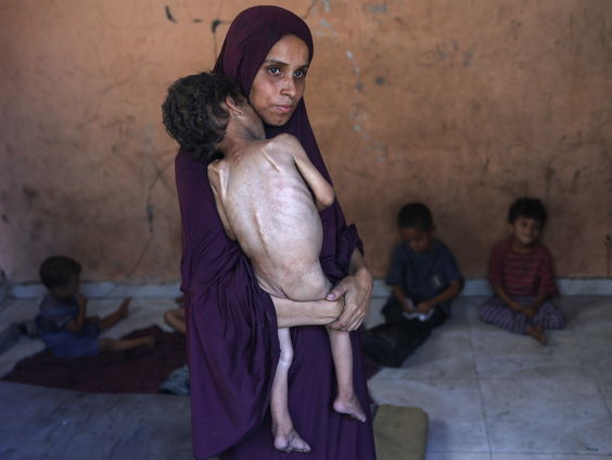 De hongersnood in Gaza