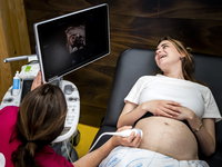 Gezondheidsraad: 13-wekenecho niet standaard voor iedere zwangere