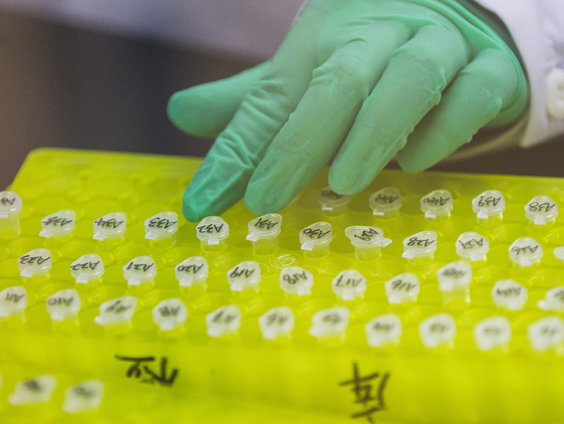 Nieuwe DNA-test om daders van seksueel geweld beter te identificeren