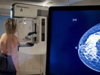 Extra MRI-scan voor vrouwen met dik borstweefsel mogelijk vanaf 2030